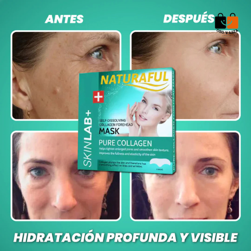 06- ✅ CollagenLift™ (Mascarillas colageno puro mejillas 6u)